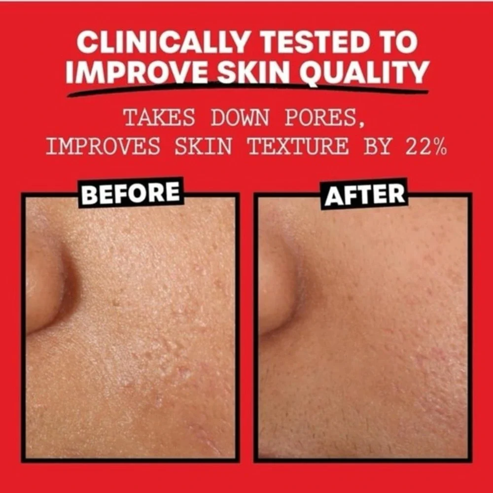 Thayers Alcohol-Free Rose Petal Witch Hazel Facial Toner for Glowing Skin, Sooth